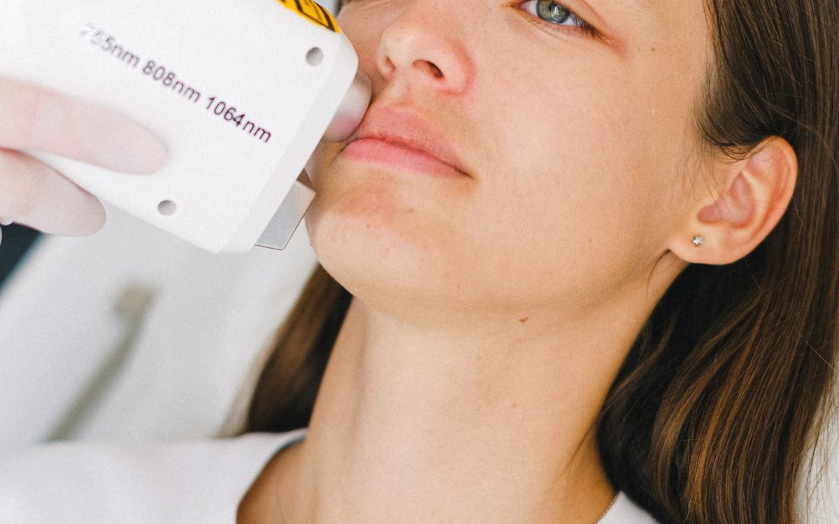 ¿La depilación láser duele? Qué vas a sentir realmente